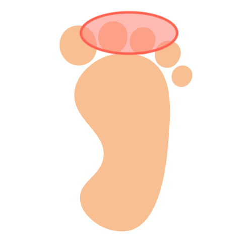 トゥーキック
